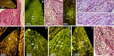 Is apomixis occurring in walnut (Juglans regia L.)? New data from progeny molecular tests and cytological investigations shed light on its reproductive system